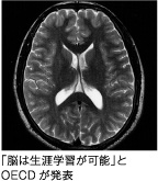 「脳は生涯学習が可能」とOECDが発表